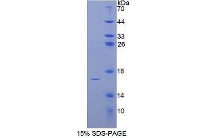 SDS-PAGE (SDS) image for BCL2-Like 11 (Apoptosis Facilitator) (BCL2L11) (AA 2-120) protein (His tag) (ABIN1877252)