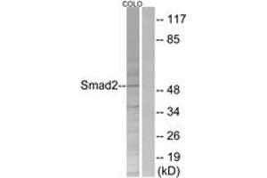 Western blot analysis of extracts from COLO205 cells, treated with serum 20% 15', using Smad2 (Ab-250) Antibody. (SMAD2 Antikörper  (AA 216-265))
