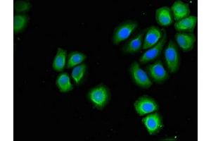 Immunofluorescence (IF) image for anti-Proteasome (Prosome, Macropain) 26S Subunit, Non-ATPase, 9 (PSMD9) (AA 103-150), (Regulatory Subunit 9) antibody (ABIN7142222)