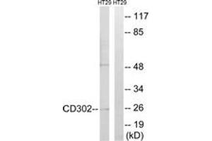 Western blot analysis of extracts from HT-29 cells, using CD302 Antibody. (DCL1 Antikörper  (AA 51-100))