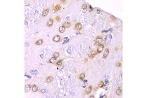 Immunohistochemistry of paraffin-embedded rat brain using RPS3A Antibody (ABIN5973489) at dilution of 1/100 (40x lens). (RPS3A Antikörper)