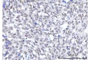 IHC analysis of RBM22 using anti-RBM22 antibody (ABIN7600268). (RBM22 Antikörper  (AA 17-406))