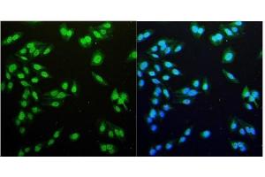 IF analysis of NDC80 using anti-NDC80 antibody (ABIN7602585).