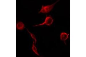 ABIN6276507 staining RAW264. (TNFRSF1B Antikörper  (C-Term))