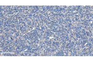 IHC analysis of DRP1/DNM1L using anti-DRP1/DNM1L antibody (ABIN7602180). (Dynamin 1-Like Antikörper  (AA 618-736))