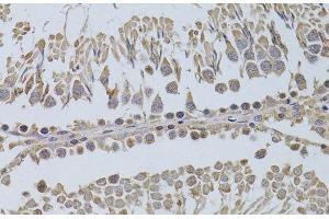 Immunohistochemistry of paraffin-embedded Rat testis using P2RY2 Polyclonal Antibody at dilution of 1:100 (40x lens). (P2RY2 Antikörper)