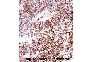 Immunohistochemistry (IHC) image for anti-Epithelial Cell Transforming Sequence 2 Oncogene (ECT2) antibody (ABIN2998212) (ECT2 Antikörper)