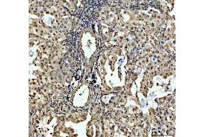 IHC analysis of SP6 using anti-SP6 antibody (ABIN5692945).