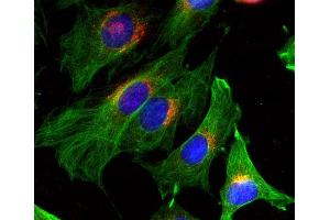 Indirect immunofluorescence on 3T3 cells (dilution 1 : 100; red) in combination with the monoclonal antibody against α-tubulin (, dilution 1 : 500; green).