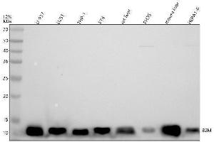 Western blot analysis of Beta-2 Microglobulin/B2M using anti-Beta-2 Microglobulin/B2M antibody (ABIN7604115).
