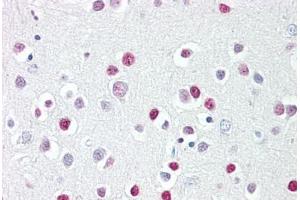 Anti-GATA4 antibody IHC staining of human brain, cortex. (GATA4 Antikörper  (AA 330-380))