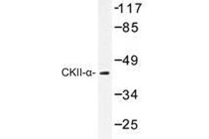 Western blot analysis of CKII-α antibody in extracts from HeLa cells. (CSNK2A1/CK II alpha Antikörper)