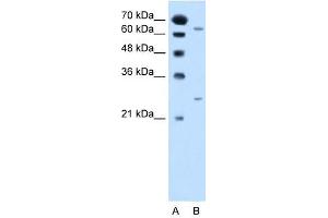 NAT2 antibody used at 2. (NAT2 Antikörper)
