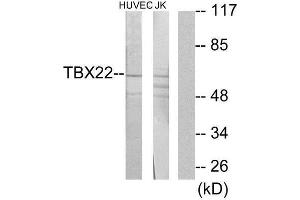 Western Blotting (WB) image for anti-T-Box 22 (TBX22) (N-Term) antibody (ABIN1850121) (T-Box 22 Antikörper  (N-Term))