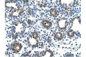 GUSB antibody was used for immunohistochemistry at a concentration of 4-8 ug/ml to stain Alveolar cells (arrows) in Human Lung. (Glucuronidase beta Antikörper  (C-Term))