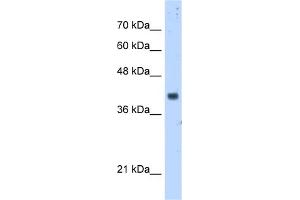 WB Suggested Anti-PDSS1 Antibody Titration:  5. (PDSS1 Antikörper  (Middle Region))
