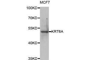 Western blot analysis of extracts of MCF7 cell line, using KRT6A antibody. (KRT6A Antikörper)