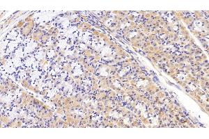 Immunohistochemistry (IHC) image for anti-Chemokine (C-C Motif) Ligand 21 (CCL21) (AA 24-134) antibody (ABIN7433810)