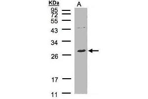 WB Image Sample(30 μg of whole cell lysate) A:Raji, 12% SDS PAGE antibody diluted at 1:500 (LAT2 Antikörper  (C-Term))