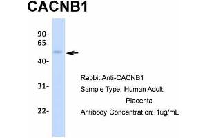 Host:  Rabbit  Target Name:  CACNB1  Sample Type:  Human Adult Placenta  Antibody Dilution:  1.
