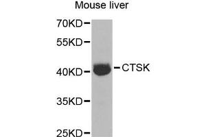 Western blot analysis of extracts of mouse liver, using CTSK antibody (ABIN5970899) at 1/1000 dilution. (Cathepsin K Antikörper)