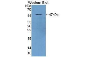 Western blot analysis of the recombinant protein. (REG1A Antikörper  (AA 10-165))
