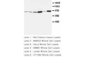 Image no. 1 for anti-Matrix Metallopeptidase 9 (Gelatinase B, 92kDa Gelatinase, 92kDa Type IV Collagenase) (MMP9) (AA 689-705) antibody (ABIN1493479) (MMP 9 Antikörper  (AA 689-705))
