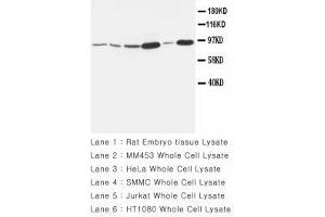 Image no. 1 for anti-Matrix Metallopeptidase 9 (Gelatinase B, 92kDa Gelatinase, 92kDa Type IV Collagenase) (MMP9) (AA 689-705) antibody (ABIN1493479)