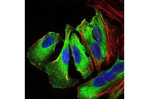 Immunocytochemistry (ICC) image for anti-Mitogen-Activated Protein Kinase 14 (MAPK14) (AA 299-360) antibody (ABIN1845584) (MAPK14 Antikörper  (AA 299-360))