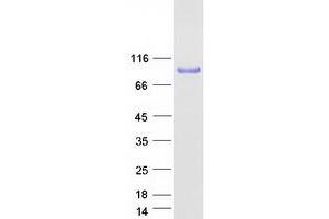 Western Blotting (WB) image for Inhibitor of kappa Light Polypeptide Gene Enhancer in B-Cells, Kinase beta (IKBKB) protein (Myc-DYKDDDDK Tag) (ABIN2723357)