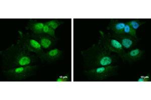 ICC/IF Image PBX1 antibody [N2C3] detects PBX1 protein at nucleus and cytoplasm by immunofluorescent analysis. (PBX1 Antikörper  (Center))