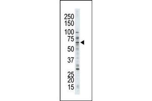Image no. 1 for anti-LIM Domain Kinase 1 (LIMK1) (N-Term) antibody (ABIN360142)