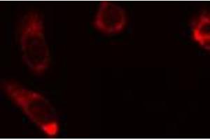 ABIN6274454 staining HuvEc cells by IF/ICC. (AKAP1 Antikörper  (Internal Region))
