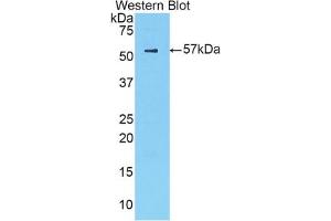 Western blot analysis of the recombinant protein. (CTSA Antikörper  (AA 215-470))