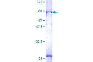 CDK14 Protein (AA 1-451) (GST tag)