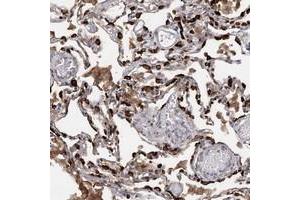Immunohistochemical staining of human lung with SLC34A2 polyclonal antibody  shows strong cytoplasmic positivity in alveolar cells at 1:200-1:500 dilution. (SLC34A2 Antikörper)