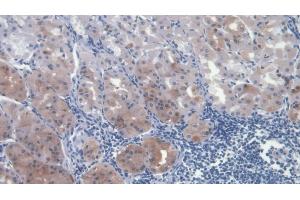 Immunohistochemistry (IHC) image for anti-Hepatocyte Growth Factor (Hepapoietin A, Scatter Factor) (HGF) (AA 495-728) antibody (ABIN7425623)