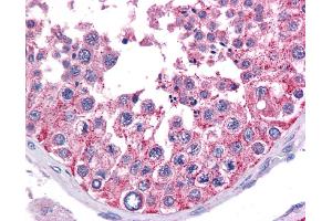Immunohistochemistry (IHC) image for anti-Wilms Tumor 1 (WT1) (Middle Region) antibody (ABIN2780340)