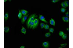 Immunofluorescence staining of A549 cells with ABIN7144503 at 1:66, counter-stained with DAPI. (Aquaporin 1 Antikörper  (AA 209-301))