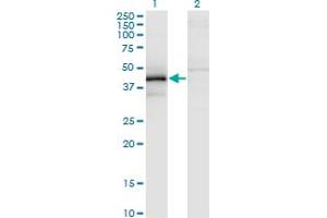 Western Blot analysis of ZFYVE19 expression in transfected 293T cell line by ZFYVE19 monoclonal antibody (M02), clone 3G4-2B11. (ZFYVE19 Antikörper  (AA 1-396))