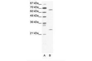 Image no. 1 for anti-Forkhead Box K2 (FOXK2) (C-Term) antibody (ABIN202858) (Forkhead Box K2 Antikörper  (C-Term))