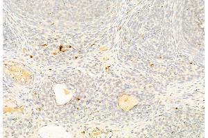 ABIN6265242 and ABIN6269269 at 1/100 staining Rat ovary tissue by IHC-P.