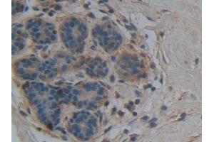 IHC-P analysis of Human Mammary gland Tissue, with DAB staining. (Apolipoprotein M Antikörper  (AA 8-188))