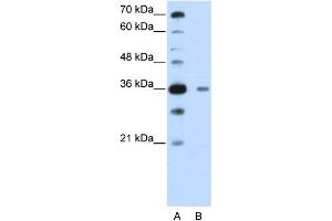 WB Suggested Anti-DAZAP1  Antibody Titration: 0. (DAZAP1 Antikörper  (C-Term))