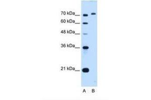 Image no. 1 for anti-GPI Anchor Attachment Protein 1 (GPAA1) (C-Term) antibody (ABIN6738244) (GPAA1 Antikörper  (C-Term))