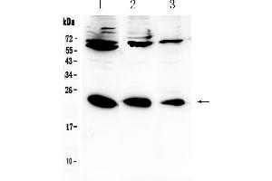 Western blot analysis of IL-2 using anti-IL-2 antibody . (IL-2 Antikörper  (AA 21-153))
