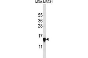 Western Blotting (WB) image for anti-Histone Cluster 2, H2aa3 (HIST2H2AA3) antibody (ABIN2997480) (HIST2H2AA3 Antikörper)