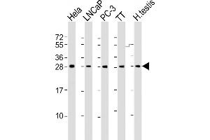 All lanes : Anti-SSX1 Antibody (Center) at 1:2000 dilution Lane 1: Hela whole cell lysate Lane 2: LNCaP whole cell lysate Lane 3: PC-3 whole cell lysate Lane 4: TT whole cell lysate Lane 5: human testis lysate Lysates/proteins at 20 μg per lane. (SSX1 Antikörper  (AA 97-128))