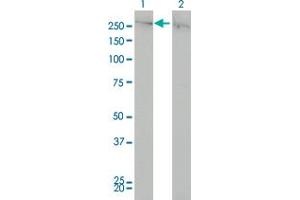 Western Blot analysis of CHD4 expression in transfected 293T cell line by CHD4 monoclonal antibody (M01), clone 4H4. (CHD4 Antikörper  (AA 1632-1730))