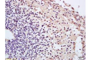 Formalin-fixed and paraffin embedded mouse embryo labeled with Anti-Phospho-cdc25A (Thr506) Polyclonal Antibody, Unconjugated (ABIN684028) at 1:200 followed by conjugation to the secondary antibody and DAB staining (CDC25A Antikörper  (pThr507))